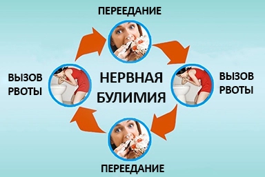 Лечение булимии в Котовске